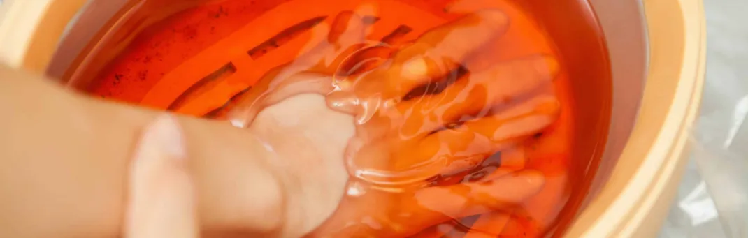 Hand receiving paraffin wax therapy for pain relief. Physical therapy rehab treatment to improve mobility.